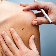 medical research Dermatologia a Roma