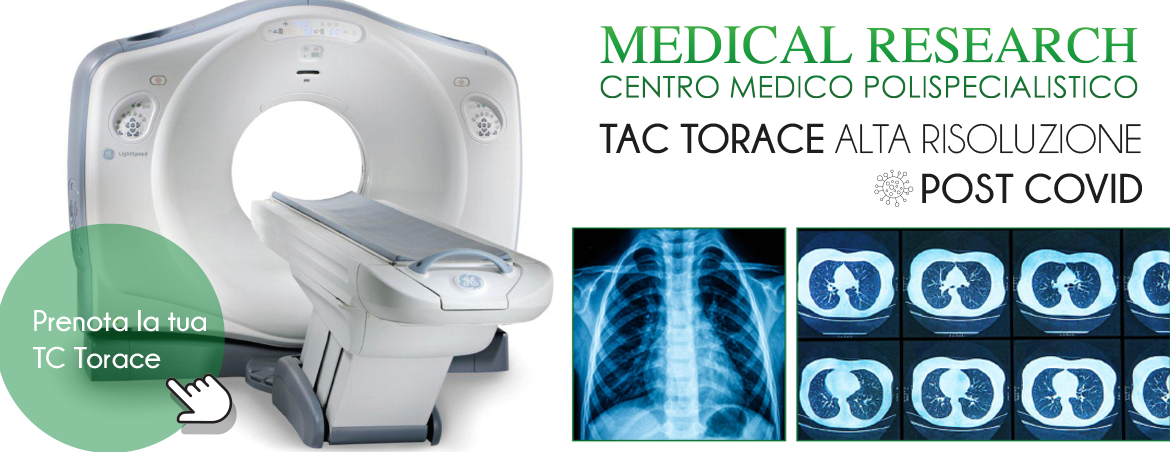 medical research TAC con e senza MDC