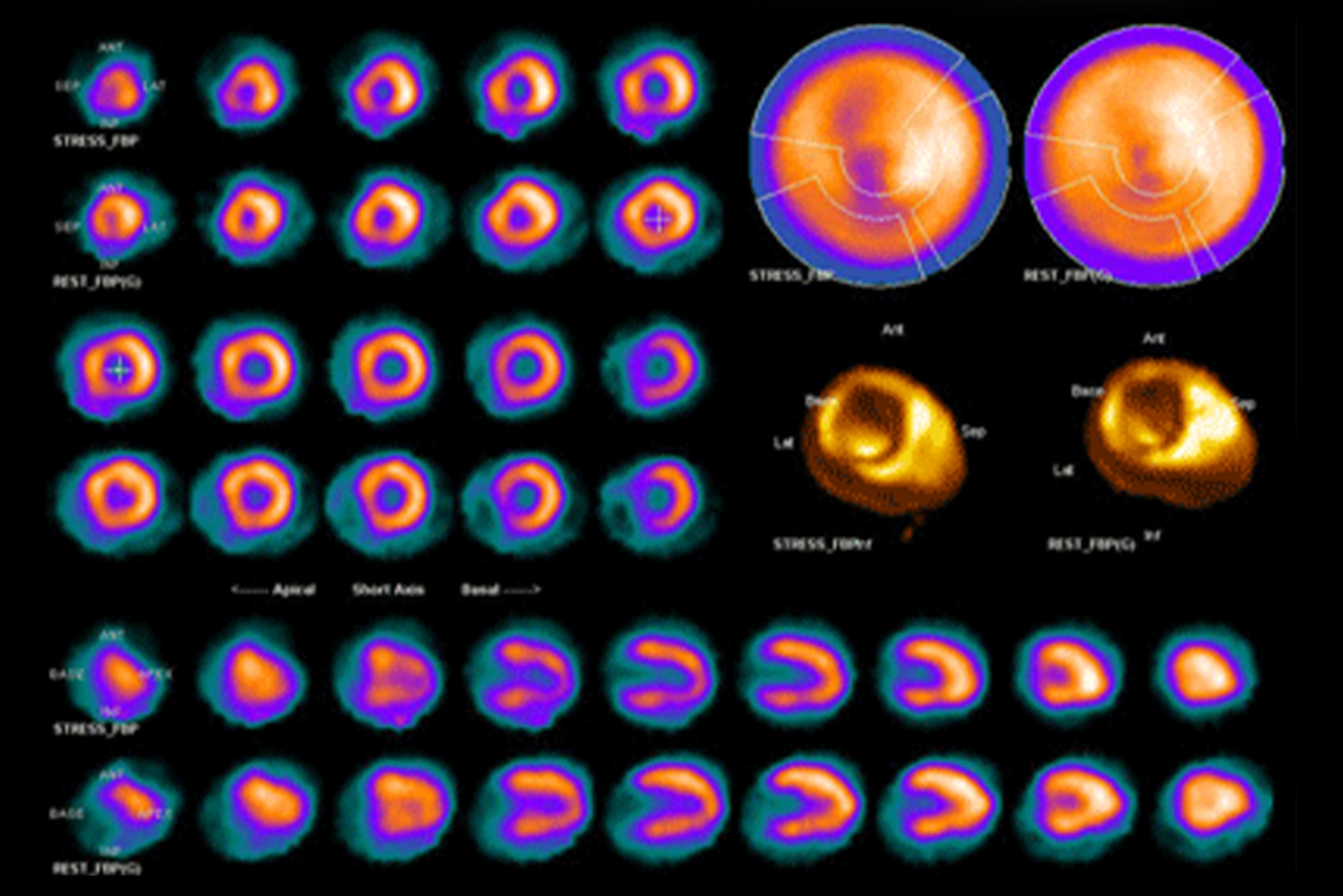 Hospital CT Scanner