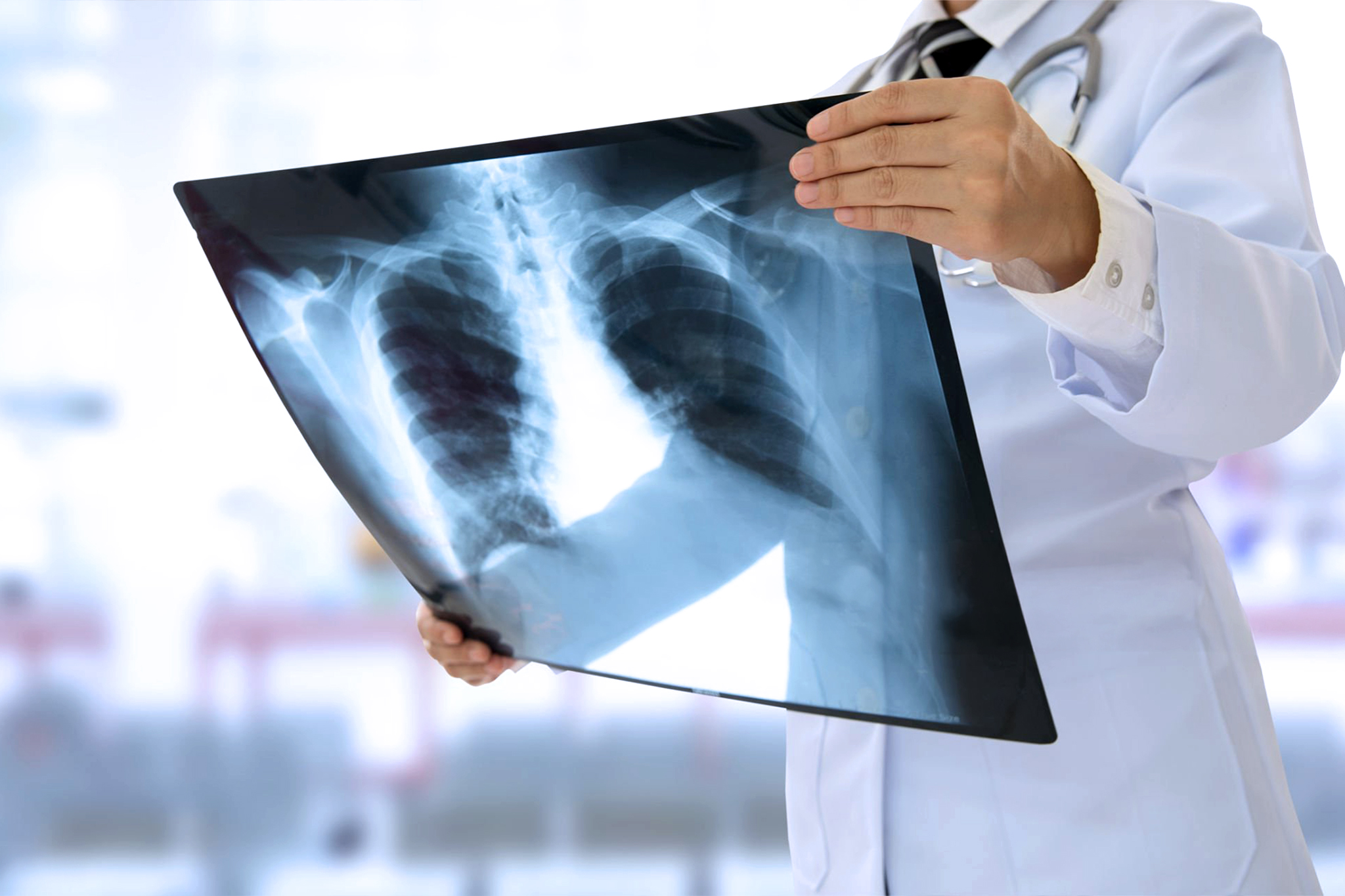 Doctor and patient making a mammography